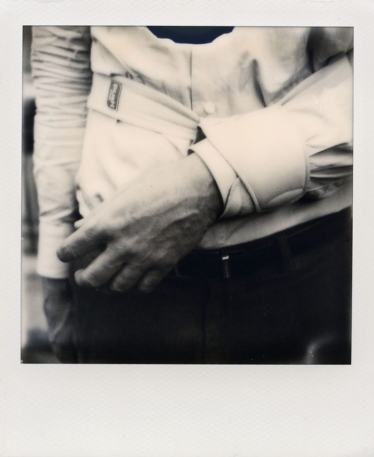 Polaroid of Daniel Richter's broken arm.